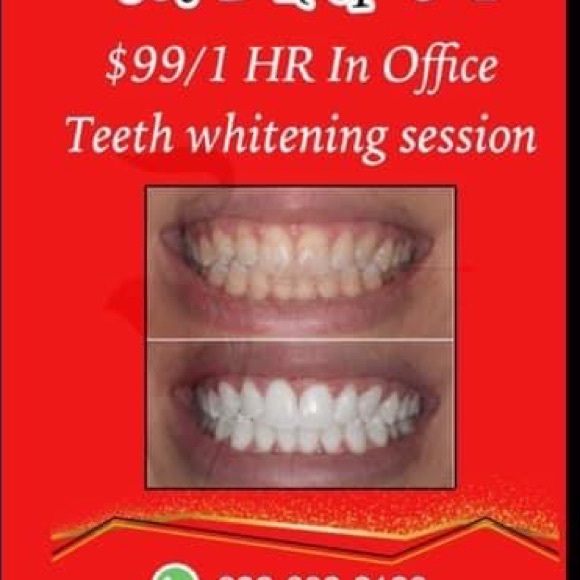 Pop it - Picture 2 of 3